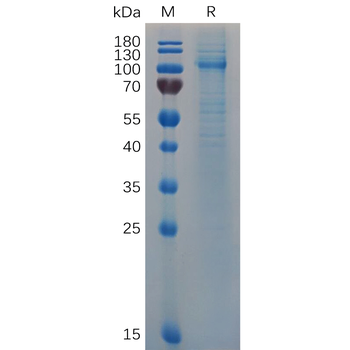 Human ABCB5 Protein, hFc Tag