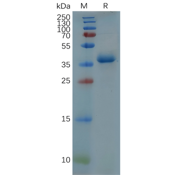 Human APRIL Protein, hFc Tag