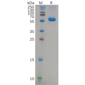 Human KIR2DL2 Protein, hFc Tag