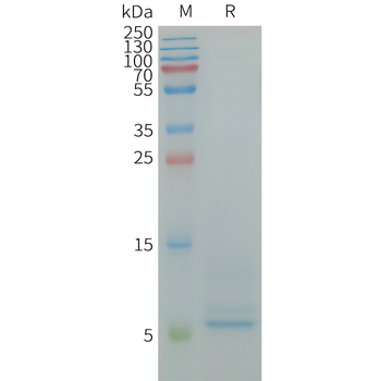 Human CD3D Protein, His Tag