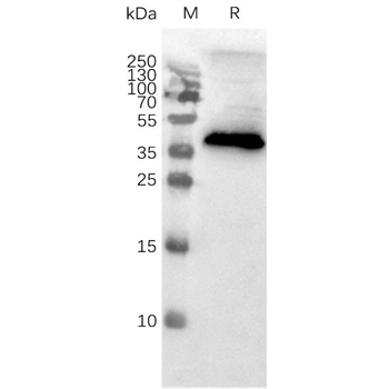 Human CCR8 full length protein-MNP