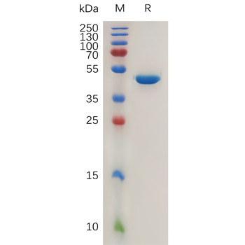 Human FGFR3 Protein, His Tag