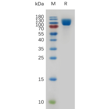 Human FURIN Protein, His Tag