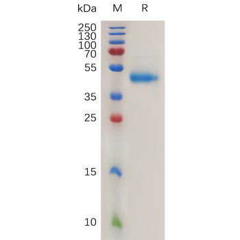 SARS-CoV-2 (Omicron BA.5) S protein RBD, hFc Tag
