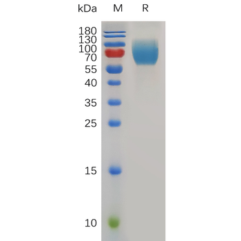 Human IGFBP2 Protein, His Tag