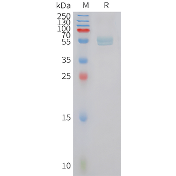Human IGFBP-1 (C-6His) Protein