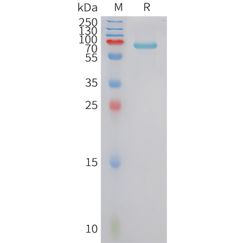 Human IL-28B Protein