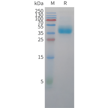 Human FGF-12 Protein