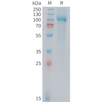 Human IL-1F10 Protein
