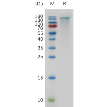 Human LRG1 Protein, His Tag