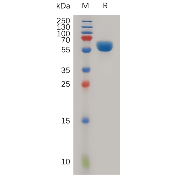 Human FGL1 Protein, His Tag