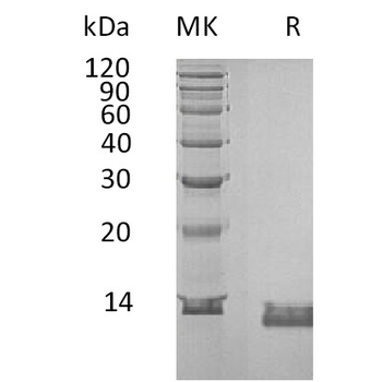 Human CALCA(26-141) Protein, hFc Tag