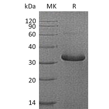 Human CGRP Protein, hFc Tag