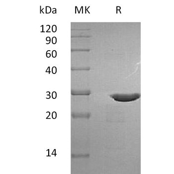Human FCGR3B Protein, His Tag