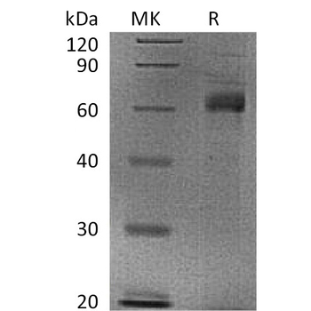 Human MANSC1 Protein, His Tag