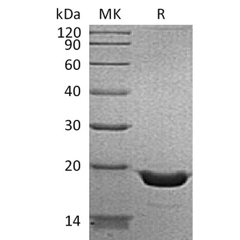 Human LAIR1 Protein, hFc Tag
