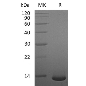 Human BTC Protein, hFc Tag