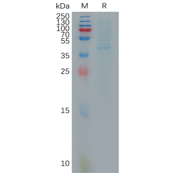 Human CD14(20-344) Protein, His Tag