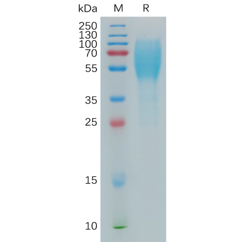 Human S100A4 Protein, hFc Tag