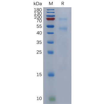 Human ANPRB Protein, His Tag