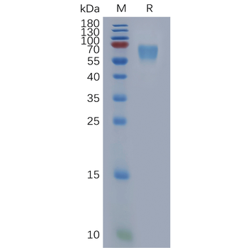Human TIMP1 Protein, hFc Tag