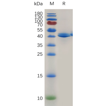 Human IL8 Protein, His Tag