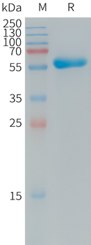 Human CDH17(567-667) Protein, mFc Tag