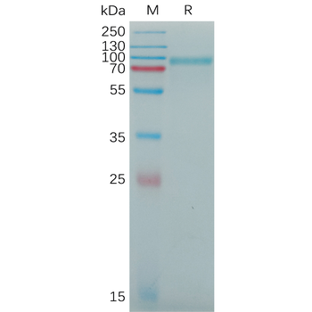 Human MICAa3 Protein, His Tag
