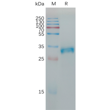 Human CD161 Protein, hFc Tag