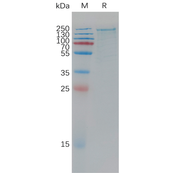 Human CX3CL1 Protein, His Tag
