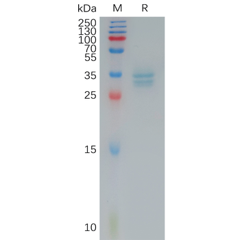 Human FGFR2 Protein, His Tag