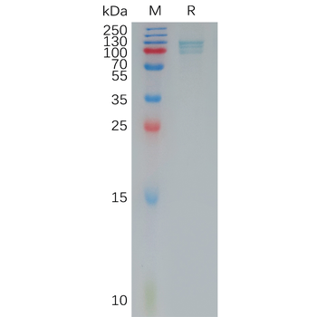 Human NTRK2 Protein, His Tag
