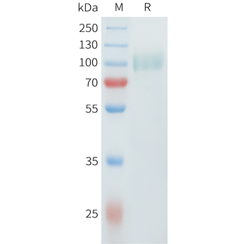 Mouse AFP Protein, His Tag