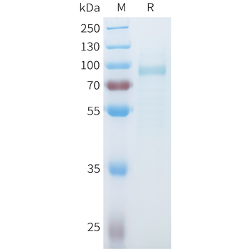 Mouse IL11RA Protein, His Tag