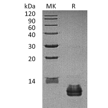 Human LOX-1 Protein, hFc Tag
