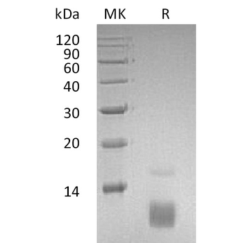 Human CLEC4C Protein, His Tag