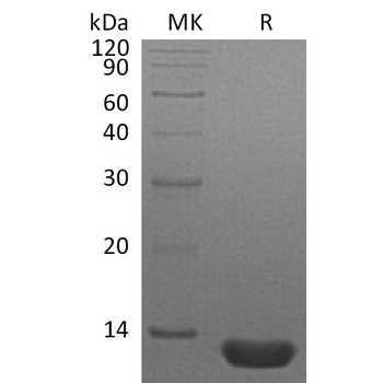 Human IGSF11 Protein, hFc Tag