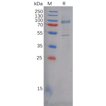 Human KIR2DL3 Protein, His Tag