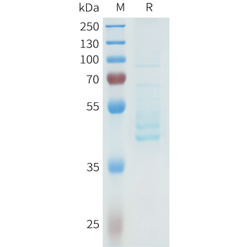 Mouse Nectin-4 Protein, His Tag