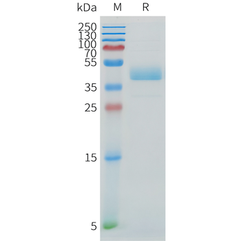 Human FGFR2 Protein, His Tag
