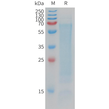 Human MMP8 Protein, His Tag