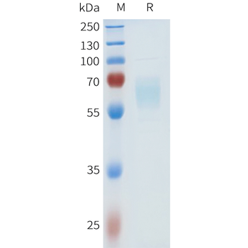 Mouse FOLR1 Protein, His Tag
