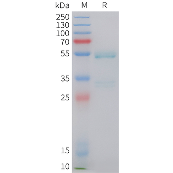Cynomolgus ROR2 Protein, C-His Tag