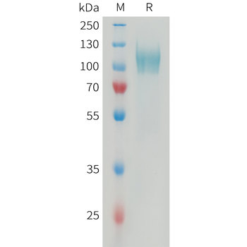 Human FCGR1A Protein, His Tag