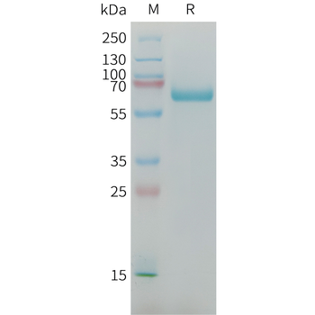 Human SPARC Protein, His Tag