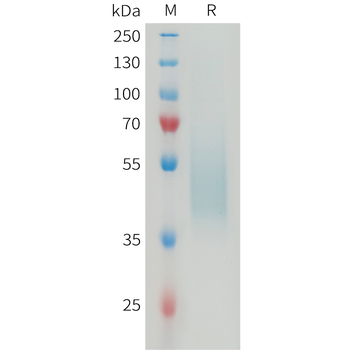 Human GPA33 Protein, His Tag