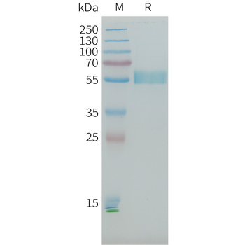 Human OSM Protein, His Tag