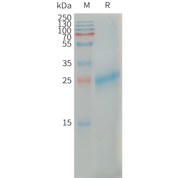 Human IL7 Protein, hFc Tag