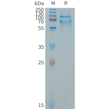Human EFNB1 Protein, His Tag