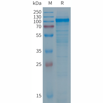 Human CADM3 Protein, His Tag